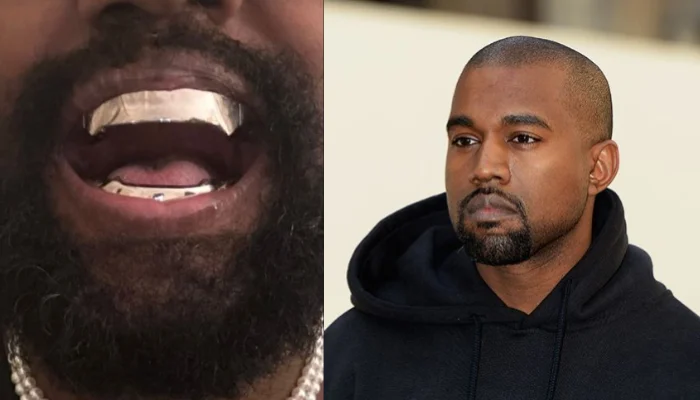 Kanye West Dentures