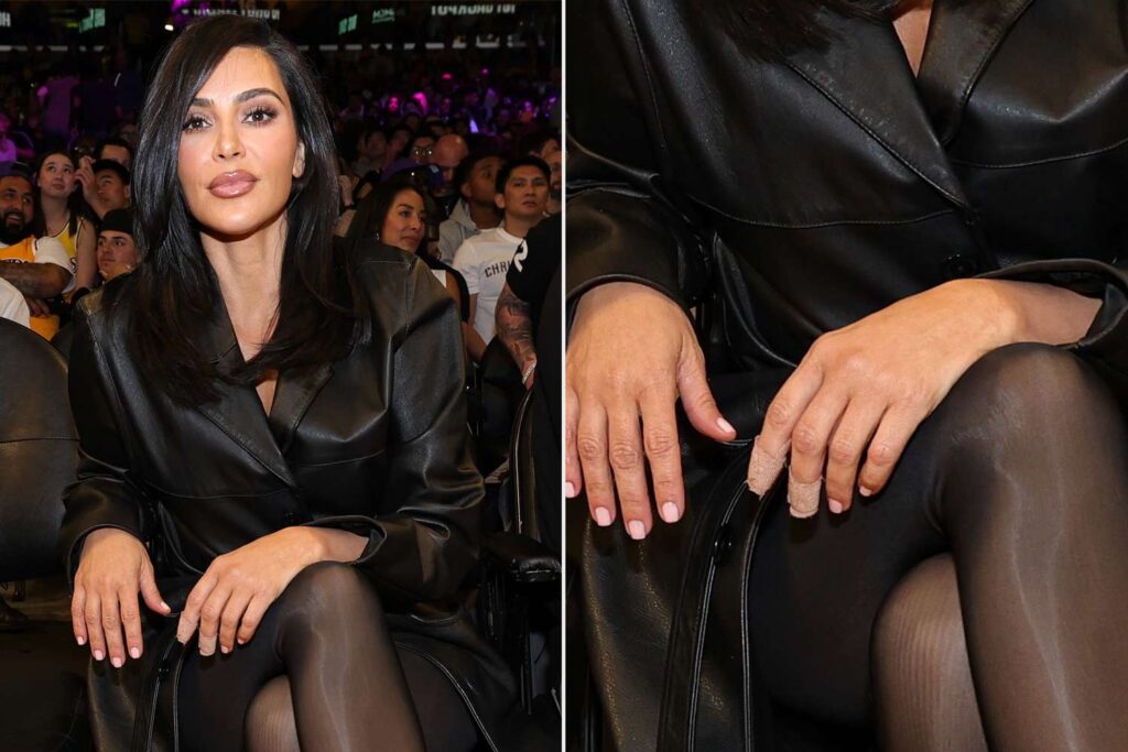 Kim Kardashian Finger Injury